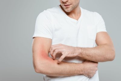 What is Psoriasis, and Do I Need A Dermatologist?