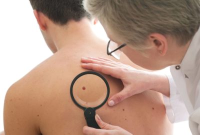 What Is Skin Cancer?