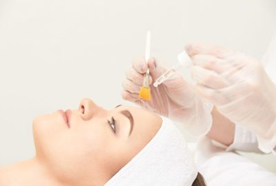 Are Chemical Peels Safe for People With Sensitive Skin?